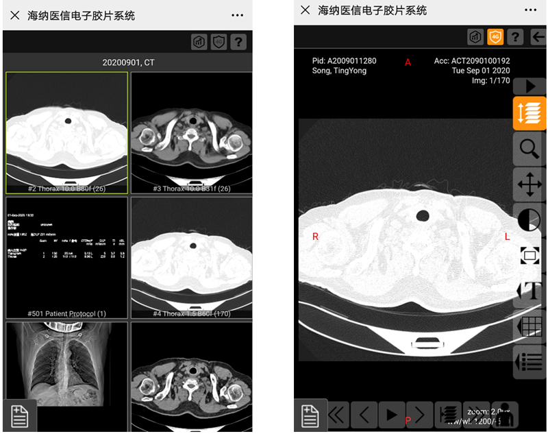 电子胶片系统